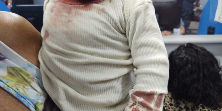 A bebezinha estava no colo da mãe. Foto: Reprodução