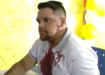 O homem levou um tiro no maxilar. Foto: Reprodução