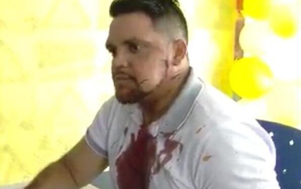 O homem levou um tiro no maxilar. Foto: Reprodução