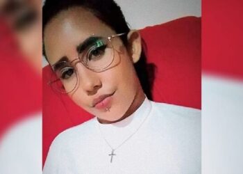 A joia foi colocada no lábio da jovem e infeccionou. Foto: Reprodução