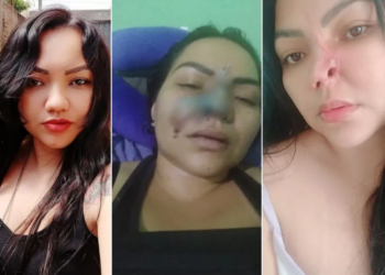 A mulher disse que ficou traumatizada. Foto: Reprodução