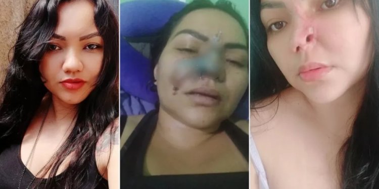 A mulher disse que ficou traumatizada. Foto: Reprodução
