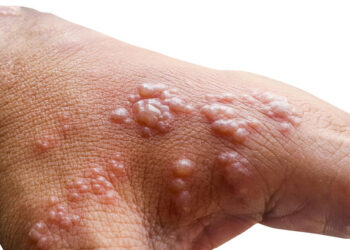 A confirmação veio nesta quinta-feira. Foto: Reprodução/Internet