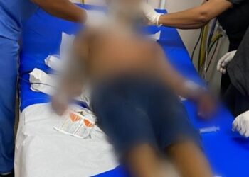 O homem foi socorrido no SPA do São Raimundo. Foto: Reprodução