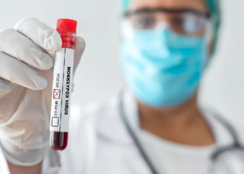 A fundação recomendou alguns cuidados para a população. Foto: Reprodução/Internet