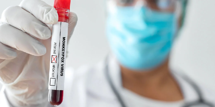 A fundação recomendou alguns cuidados para a população. Foto: Reprodução/Internet