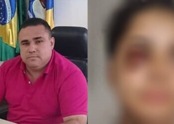 A agressão ocorreu no condomínio que a vítima mora, na Chapada. Foto: Reprodução