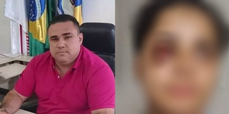 A agressão ocorreu no condomínio que a vítima mora, na Chapada. Foto: Reprodução