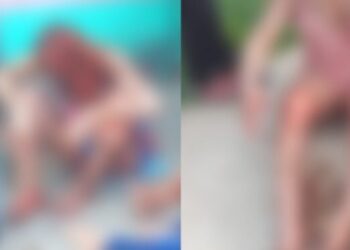 As vítimas tiveram queimaduras de segundo e terceiro grau. Foto: Reprodução