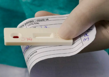 A procura por testes rápidos tem aumentado nas últimas semanas. Foto: Agência Senado/Reprodução