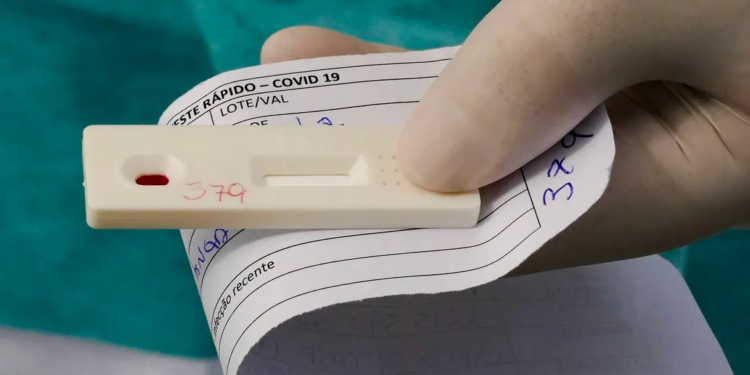 A procura por testes rápidos tem aumentado nas últimas semanas. Foto: Agência Senado/Reprodução