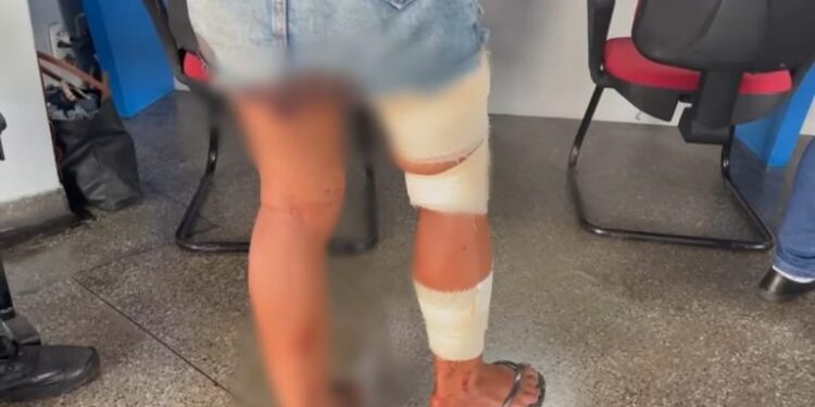 O crime ocorreu na tarde desta segunda-feira (31). Foto: Reprodução