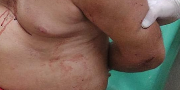 O homem foi preso e autuado em flagrante. Foto: Reprodução