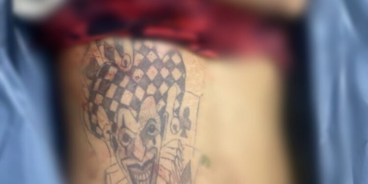 O crime ocorreu nesta terça-feira (29) e o homem não resistiu. Foto: Reprodução