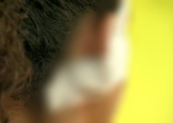 As agressões só acabaram após o homem achar que a vítima já estava morta. Foto: Reprodução/Internet