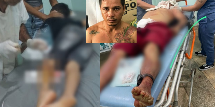 Eles foram atendidos no hospital e 'Tróia' estaria em estado grave. Foto: Reprodução