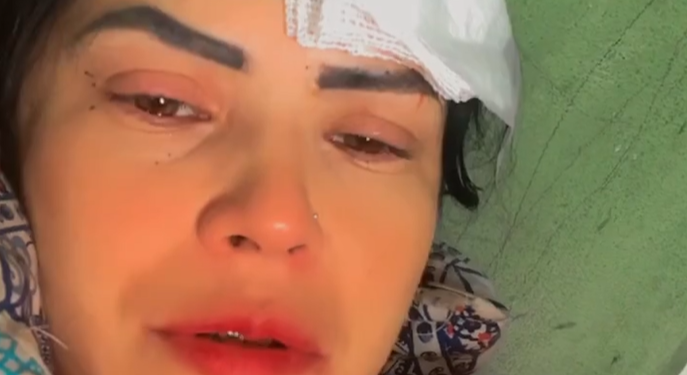 A jovem disse que não conhece a mulher que a atacou. Foto: Reprodução