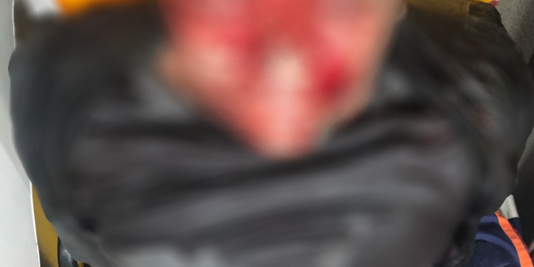 Anderson Videira Lima, 38 anos