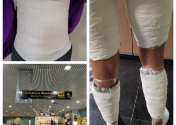 A mulher foi flagrada ao passar pelo aparelho de Raio-X. Foto: Reprodução