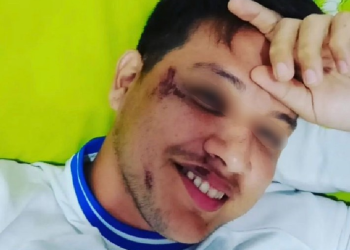 O rapaz disse que não lembra como chegou em casa, mas viu pelas câmeras que foi deixado por um mototaxista. Foto: Reprodução