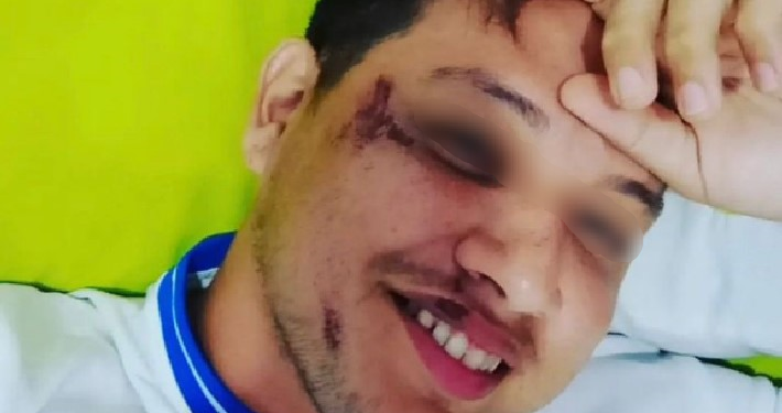 O rapaz disse que não lembra como chegou em casa, mas viu pelas câmeras que foi deixado por um mototaxista. Foto: Reprodução