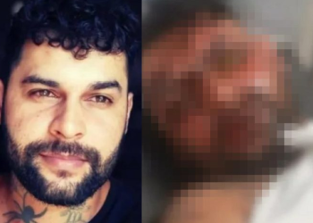 O homem trabalha como tatuador e perdeu um lado da visão. Foto: Reprodução