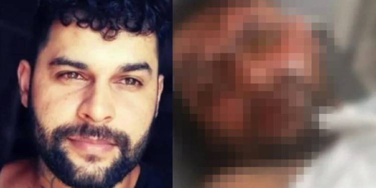 O homem trabalha como tatuador e perdeu um lado da visão. Foto: Reprodução