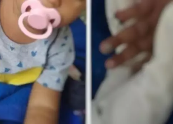 A criança deu entrada no hospital por causa de uma picada de mosquito que não melhorava. Foto: Reprodução