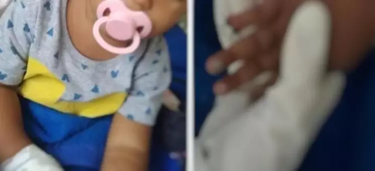 A criança deu entrada no hospital por causa de uma picada de mosquito que não melhorava. Foto: Reprodução