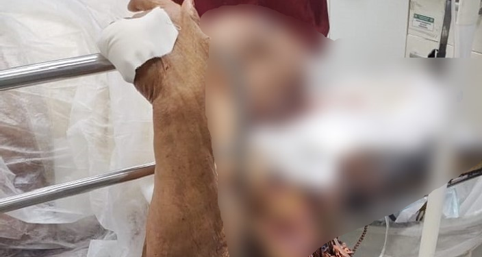 A idosa está internada no Hospital e Pronto-Socorro Dr. Platão Araújo. Foto: Reprodução