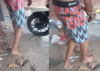 O trio foi atingido nos dedos, mãos e braços. Foto: Reprodução