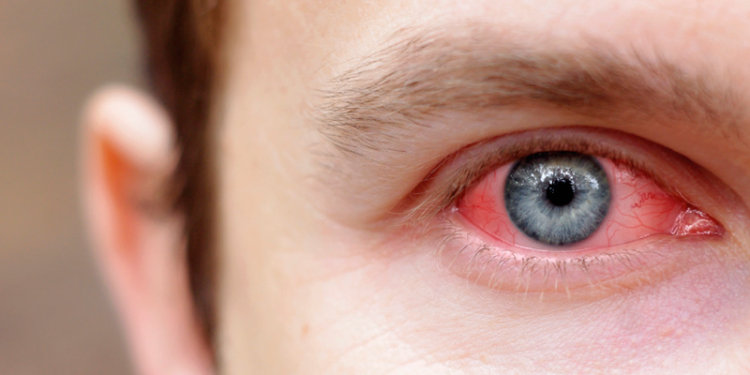 Os médicos alertam para os novos sintomas. Foto: Reprodução/Internet