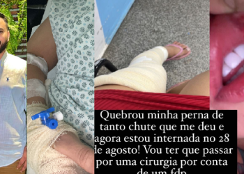 A mulher disse que vai precisar fazer uma cirurgia. Foto: Reprodução/Instagram