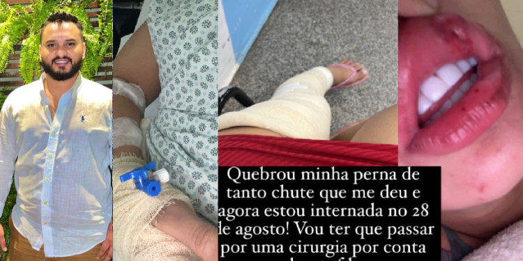 A mulher disse que vai precisar fazer uma cirurgia. Foto: Reprodução/Instagram