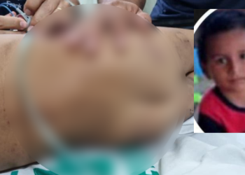 Arthur estava em estado grave. Foto: Reprodução