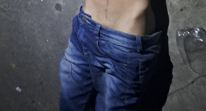 O homem estava com o amigo no segundo andar de uma construção. Foto: Reprodução