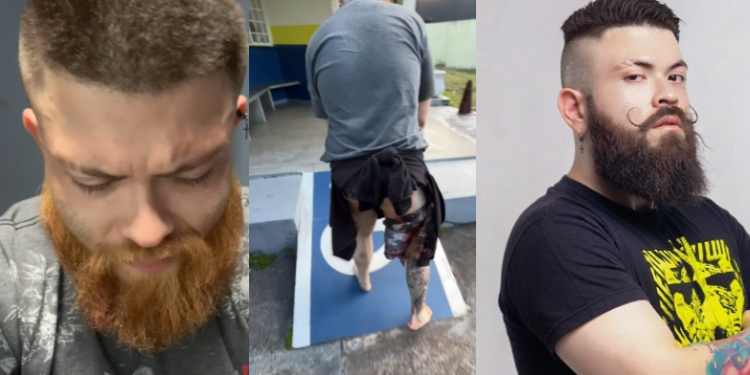 O homem de 28 anos faz uso de entorpecentes e reagiu à prisão. Foto: Reprodução