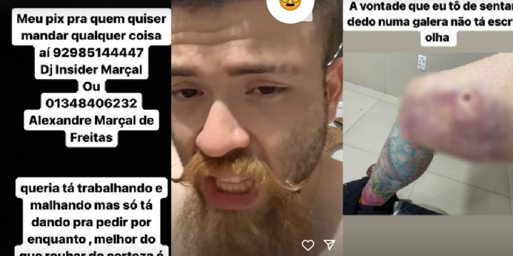 O homem chegou a ser preso e baleado no início deste mês. Foto: Reprodução