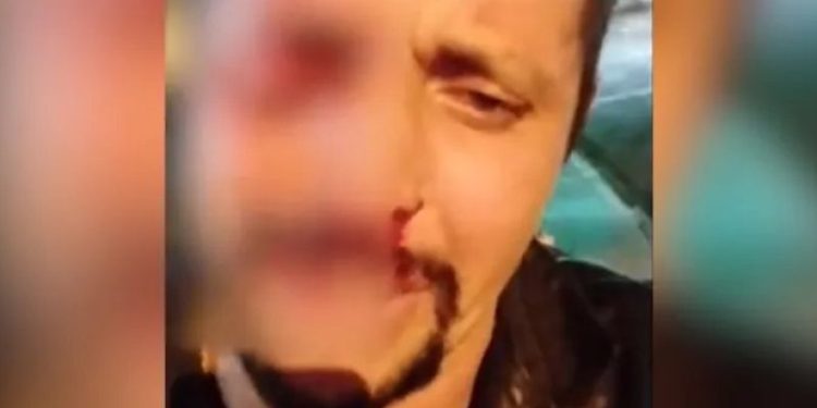 O homem estava na própria moto e foi confundido com um ladrão. Foto: Reprodução