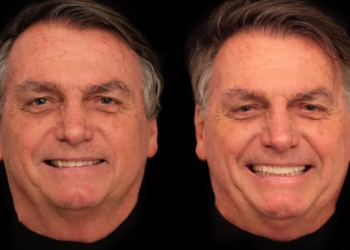 O procedimento foi finalizado na última sexta-feira. Foto: Reprodução