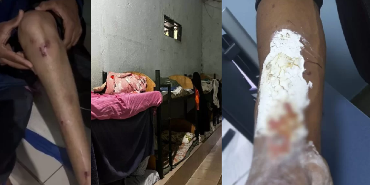 Os pacientes não tinham alimentação adequada e nem medicação. Foto: Divulgação