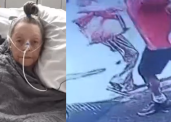 A idosa quebrou o fêmur. Foto: Reprodução