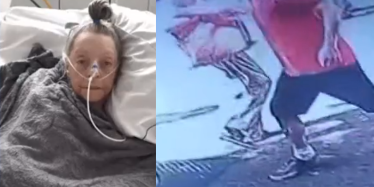 A idosa quebrou o fêmur. Foto: Reprodução