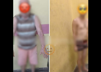 O idoso foi encontrado com vários hematomas no braço. Foto: Divulgação/PC-AM