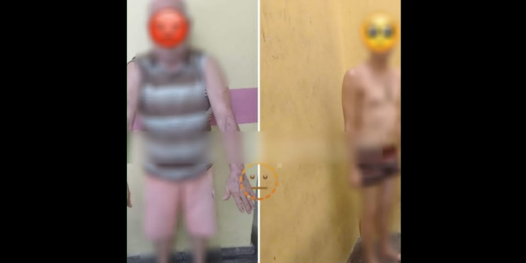 O idoso foi encontrado com vários hematomas no braço. Foto: Divulgação/PC-AM