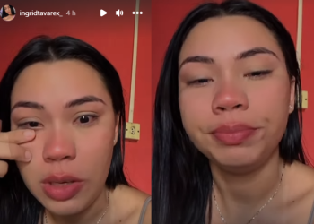 A jovem disse que resolveu contar para servir de alerta. Foto: Reprodução