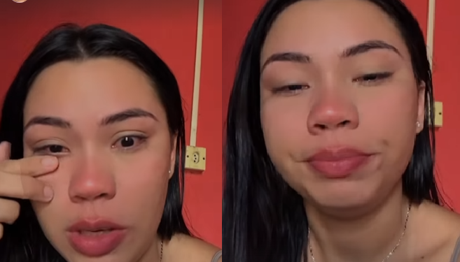 A jovem disse que resolveu contar para servir de alerta. Foto: Reprodução