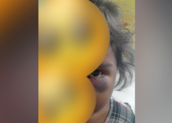 A menina tem apenas 3 anos e ainda caiu no chão. Foto: Reprodução