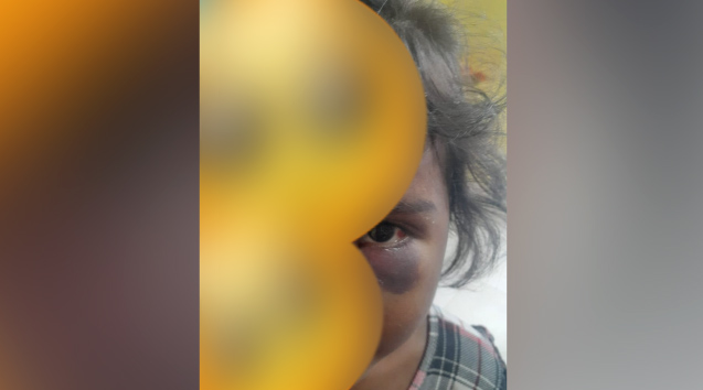 A menina tem apenas 3 anos e ainda caiu no chão. Foto: Reprodução