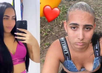 A jovem ficou cheia de buraco na cabeça após passarem a máquina no zero. Foto: Reprodução